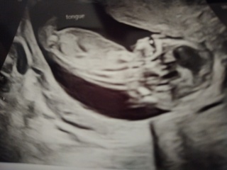 Boy or Girl? Nub guess
