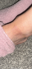 What is this on my foot?!