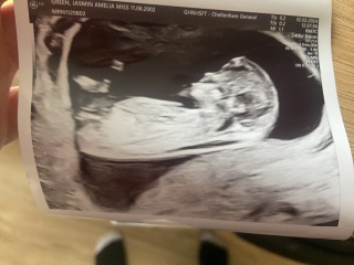 12 week nub theory/gender guesses