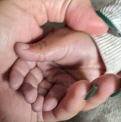 Purple lips and hands?