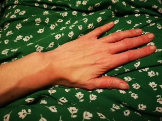 Parasthesia resolved <24 hrs post B12 shot? Also big veins