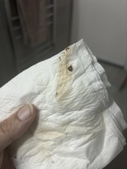 Dark brown spotting 13 weeks *TMI PICS*