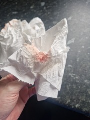 Implantation Bleeding