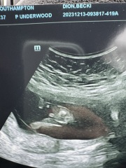 Boy/Girl Or Cord