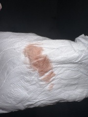 Pregnant after loss now spotting help!