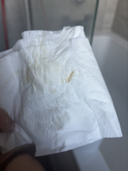Blood streaked discharge TMI pics