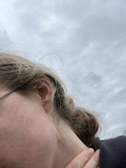 Skincare help! Small bumps over forehead etc
