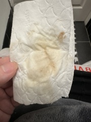Mucus plug