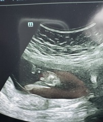 Girl or boy?