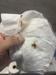 Dark brown spotting 13 weeks *TMI PICS*