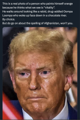 Has Biden had tonnes of botox?