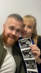 12.5 week ultrasound nub theory ??