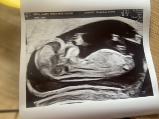 12 week nub theory/gender guesses