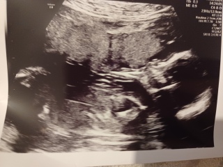 17+6 scan