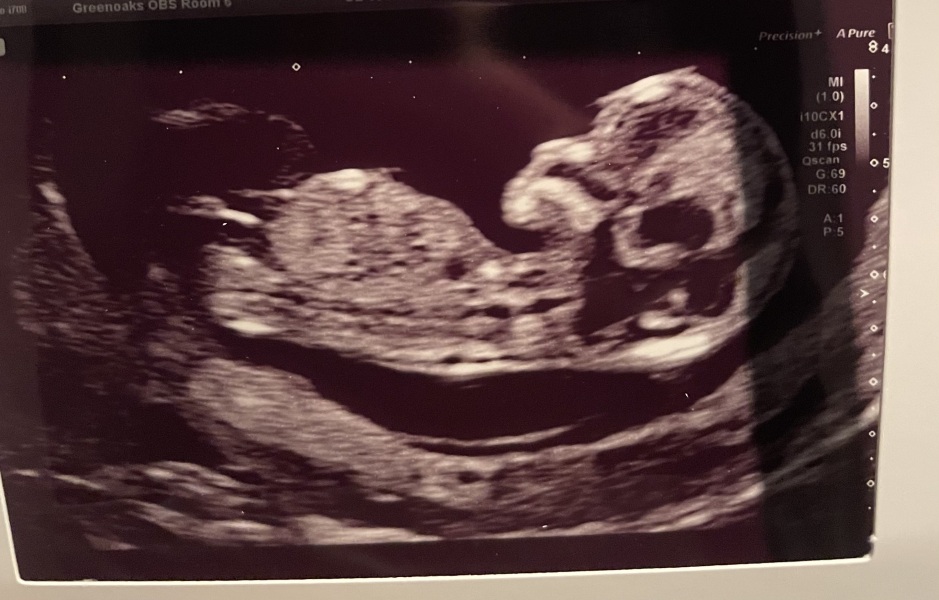 Boy or girl 🥰