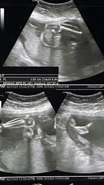 Can somebody guess the gender???