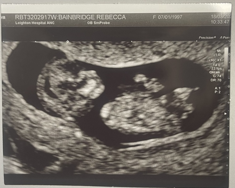 OCTOBER 2024 BABIES :) THREAD 3