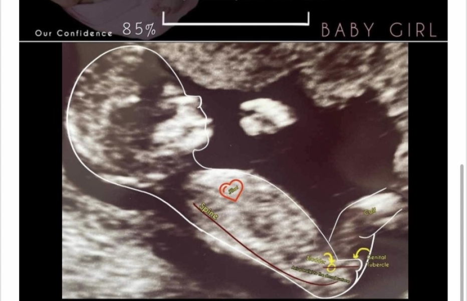 Due September - Thread 5! 🐣❤️🧡💛