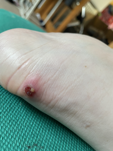 Does this look infected