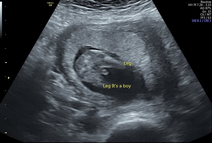 Due September - Thread 5! 🐣❤️🧡💛