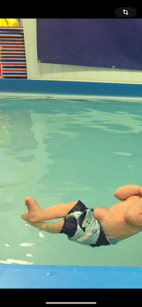 Is this baby hernia huge?