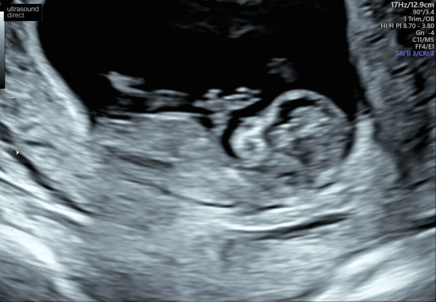 October 2024 Babies thread 2 👶