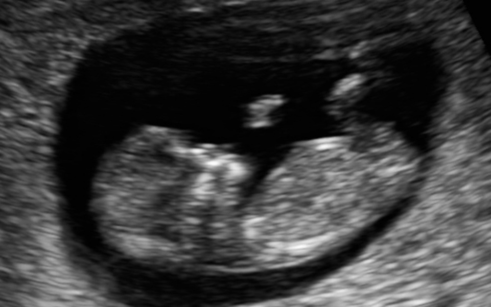 12 Week Nub Theory