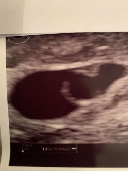 Early scan thoughts please (pic)