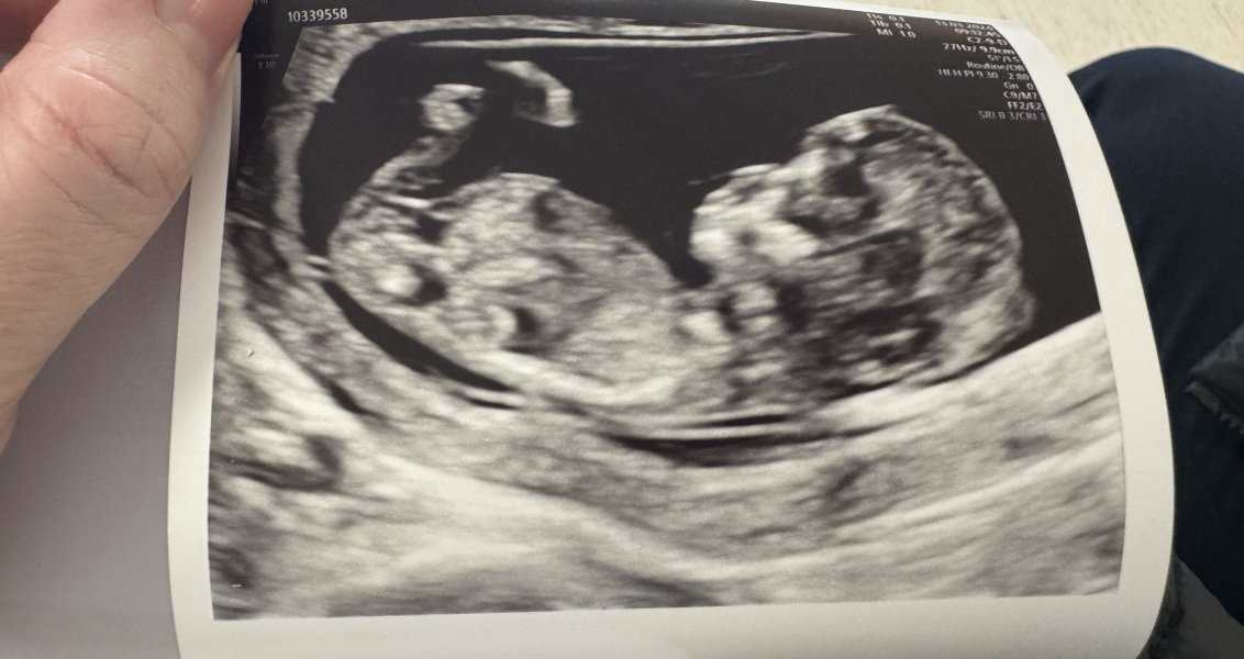 Due September - Thread 5! 🐣❤️🧡💛