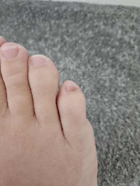 Really weird mark under nail