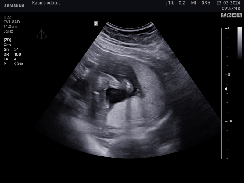 Boy or girl?
