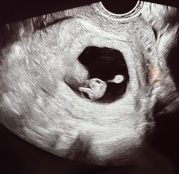 October 2024 Babies thread 2 👶