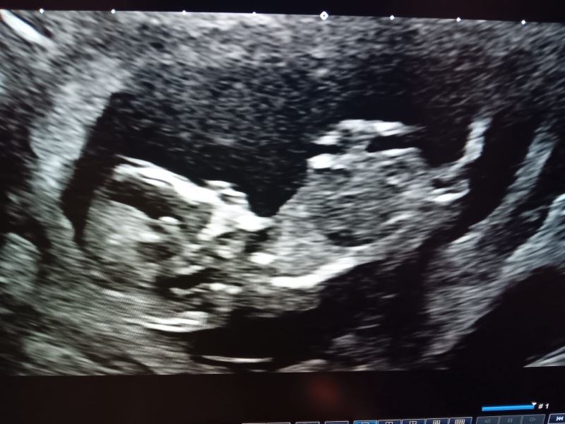 Due September 4.5 🐣♥️🧡💜