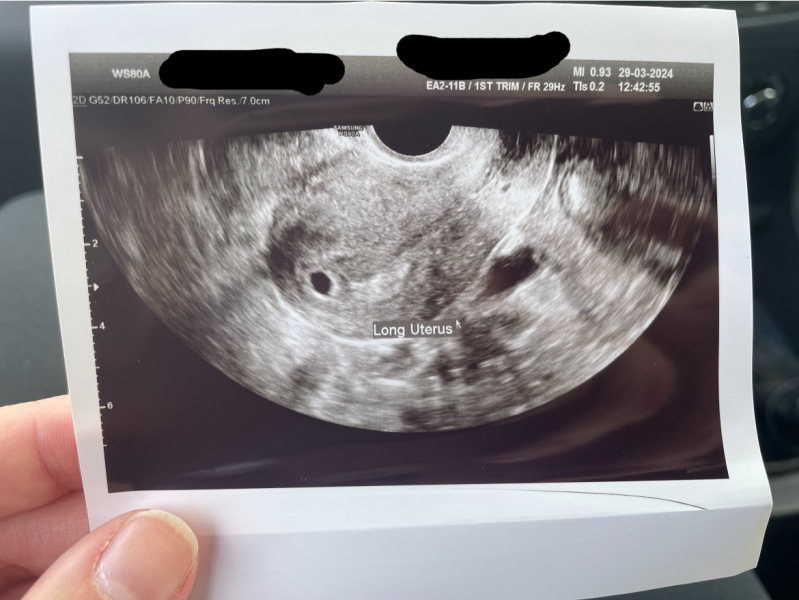 November 2024 Babies- Part 2!