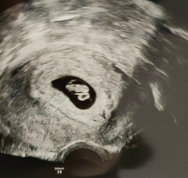October 2024 Babies thread 2 👶