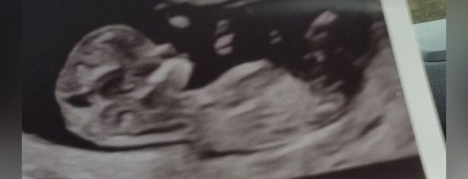 Boy or girl?! 12w3d