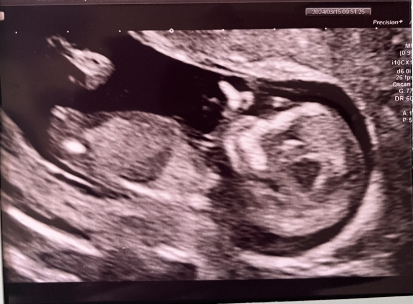 Due September - Thread 5! 🐣❤️🧡💛