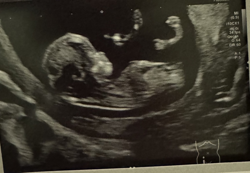 Due September 4.5 🐣♥️🧡💜