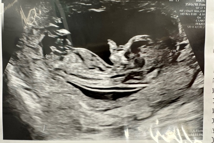 12 weeks gender guess