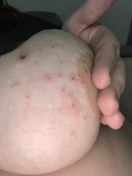 Advice on rash