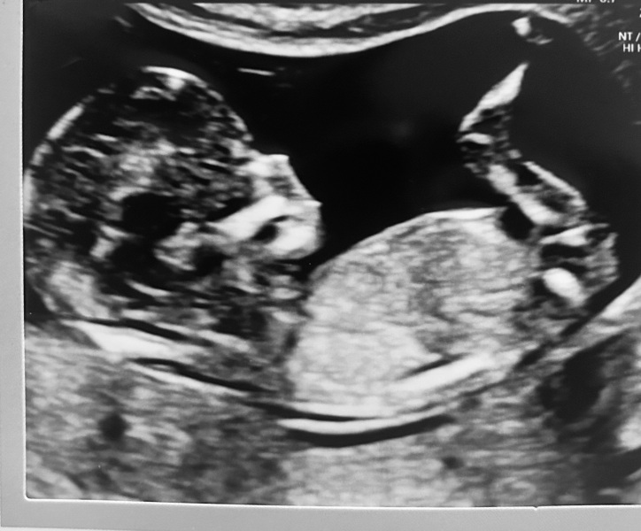 Due September - Thread 5! 🐣❤️🧡💛