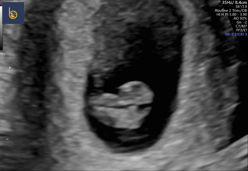 November 2024 Babies- Part 2!