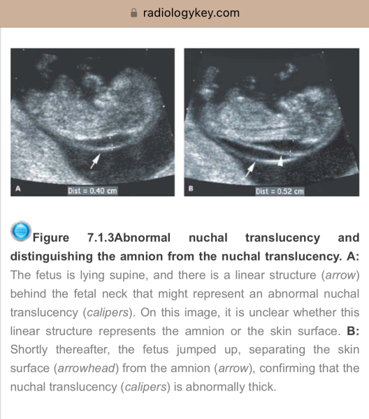 This is bad news isn’t it? (Scan photos included)