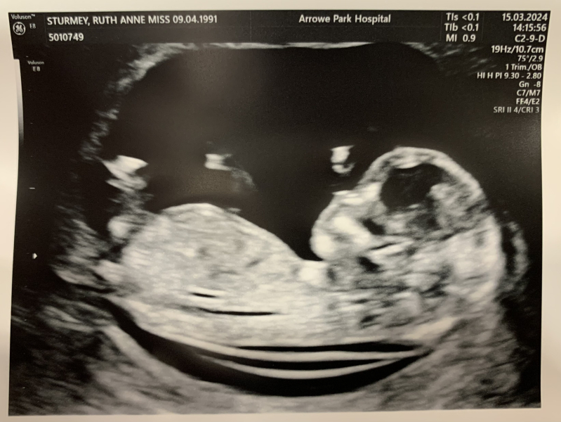 Due September - Thread 5! 🐣❤️🧡💛