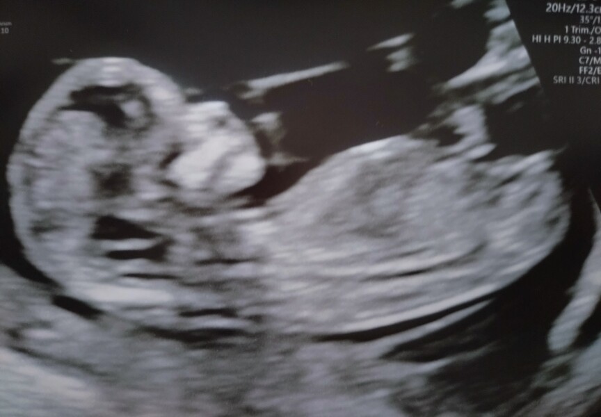 OCTOBER 2024 BABIES :) THREAD 3