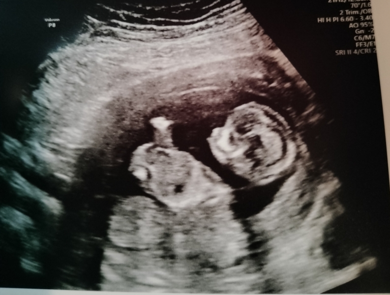 Gender guesses? For fun