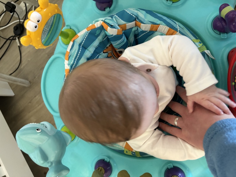 Is this Plagiocephaly? Also, does plageodephaly cause brain damage/delays?