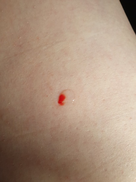 Continuing Mounjaro... Part 2