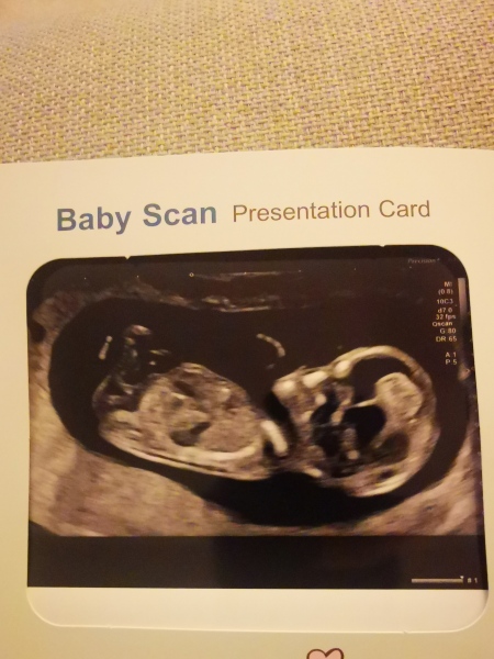 Due September - Thread 5! 🐣❤️🧡💛