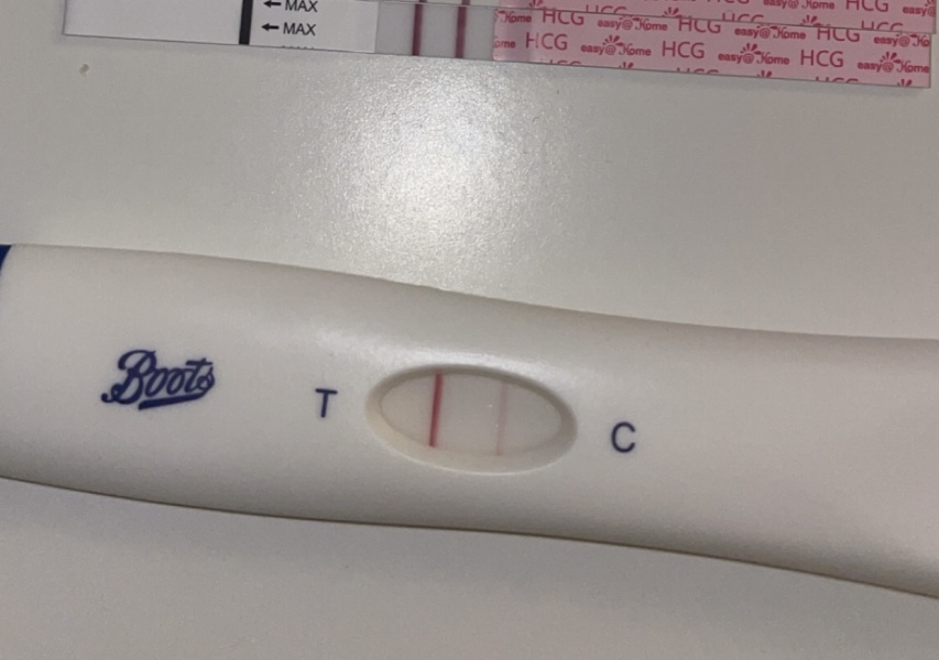 TW Pregnant after loss. So anxious about another loss. Could the anxiety of this cause another MC?